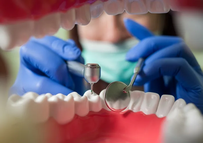 5 Signs That You May Need a Composite Filling To Restore Your Smile