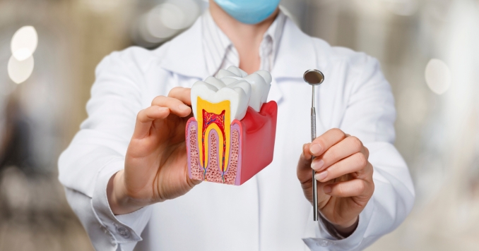 exploring the connection between dental hygiene practices and root canal needs in san leandro