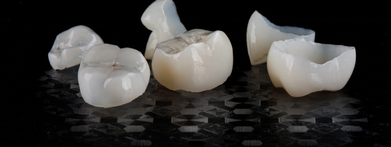 Same-Day Dental Crowns: A Faster, More Convenient Solution for Restorations